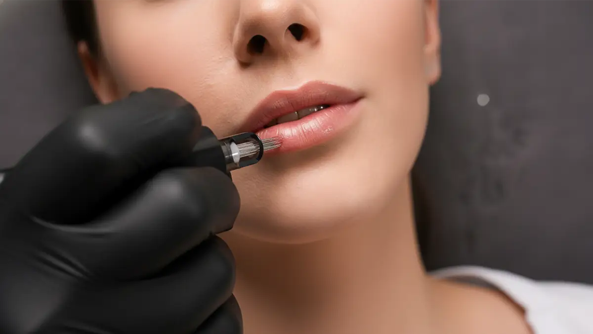 Resultado después del tratamiento de labios